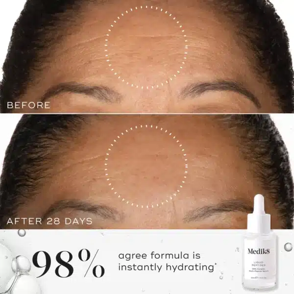 Anti-aging voordelen van Medik8 Liquid Peptides zichtbaar op de huid